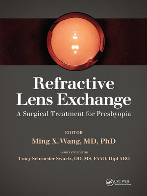 cover image of Refractive Lens Exchange